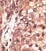 AP13203PU-N - CREB3L1 / OASIS