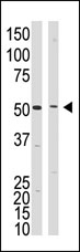 AP13205PU-N - Presenilin-1