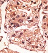 AP13205PU-N - Presenilin-1