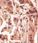 AP13219PU-N - SIRT6