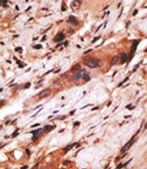 AP13224PU-N - CD82