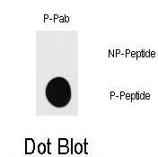 AP12802PU-N - RPS6KB1 / STK14A