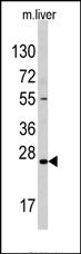 AP13235PU-N - Sclerostin / SOST