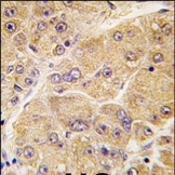 AP13236PU-N - Sclerostin / SOST
