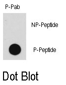 AP12835PU-N - MAP3K8 / TPL-2