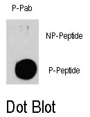 AP12837PU-N - Tuberin / TSC2