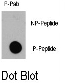 AP12839PU-N - EIF4EBP1 / 4E-BP1