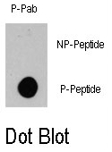 AP12840PU-N - B-Raf proto-oncogene
