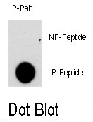 AP12851PU-N - NFATC2