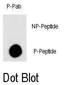 AP12853PU-N - Tuberin / TSC2