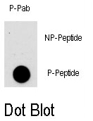 AP12855PU-N - AKT1 / PKB
