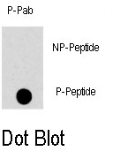 AP12858PU-N - MAPK8 / JNK1