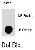 AP12863PU-N - MAP4K4