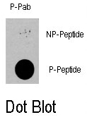 AP12874PU-N - PDPK1