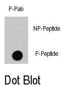 AP12876PU-N - RAF1