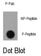 AP12877PU-N - RPS6KA1