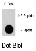 AP12878PU-N - RPS6KA3 / RSK2