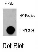 AP12884PU-N - AKT3 / PKB gamma
