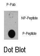AP12886PU-N - TSC1 / Hamartin