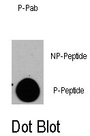 AP12894PU-N - Tuberin / TSC2