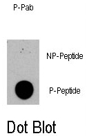 AP12895PU-N - Tuberin / TSC2