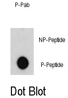 AP12896PU-N - ABL1