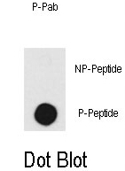 AP12899PU-N - DNA-PKcs / PRKDC / XRCC7