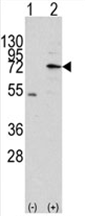 AP11445PU-N - MIPEP