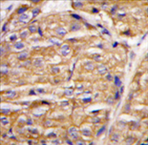 AP11445PU-N - MIPEP