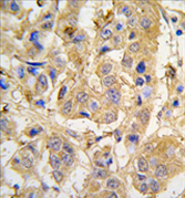AP11446PU-N - MIPEP