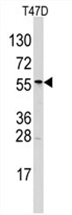 AP11461PU-N - ALDH6A1 / MMSDH