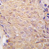 AP11461PU-N - ALDH6A1 / MMSDH