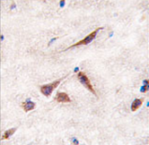 AP11463PU-N - ERAS / HRAS2