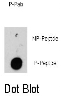 AP12903PU-N - Integrin-linked protein kinase