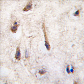 AP11464PU-N - ERAS / HRAS2