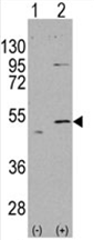 AP11468PU-N - ALDH5A1 / SSADH