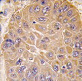 AP11468PU-N - ALDH5A1 / SSADH