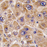 AP11469PU-N - ALDH5A1 / SSADH
