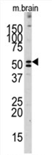 AP11472PU-N - Alkaline phosphatase / ALPL