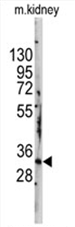 AP11474PU-N - STAP1 / BRDG1