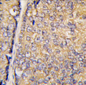 AP11474PU-N - STAP1 / BRDG1