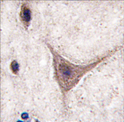 AP11486PU-N - Cadherin-10