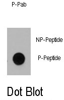 AP12931PU-N - DNMT1