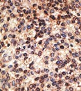 AP13110PU-N - Jagged-2 / JAG2