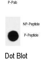 AP12943PU-N - CDKN1B / KIP1