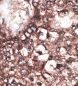 AP13124PU-N - APOER2 / LRP8