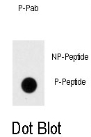 AP12946PU-N - DNMT1