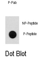 AP12956PU-N - TERT