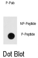 AP12959PU-N - Anthrax toxin receptor 1 / ANTXR1