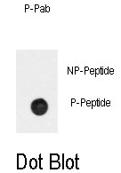 AP12960PU-N - Beta-2 adrenergic receptor